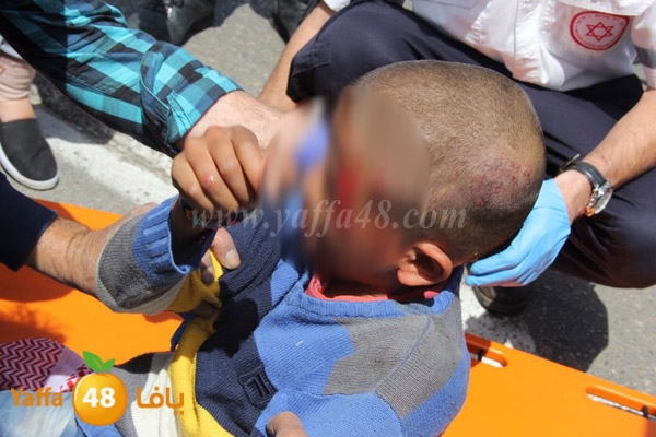 kid accedent lud 0401 (9).JPG